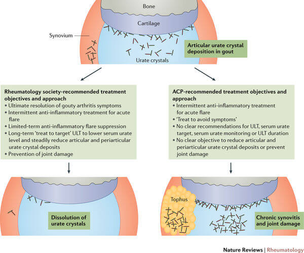 Gout Doctor Dispute Technical Explanation